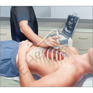 Introduction Training to  Critical Care Ultrasound (Scanning Technique and Ultrasound Anatomy)